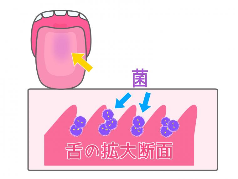 免疫力とお口の中の関係