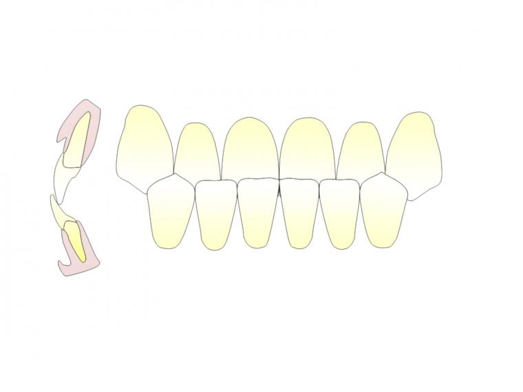 下顎の骨とこどもの反対咬合について