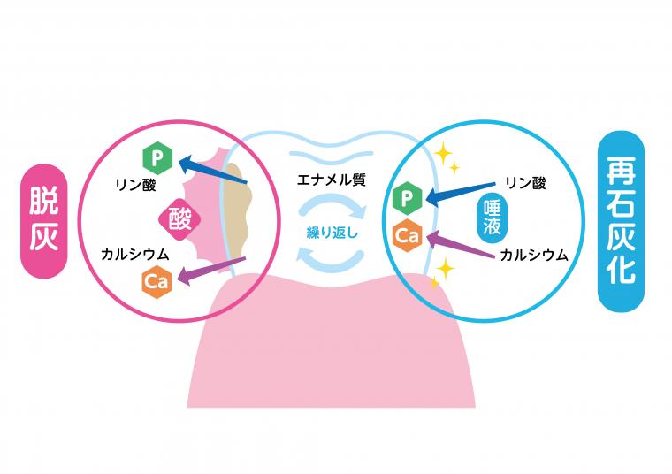 歯磨きをしているのになぜ虫歯になるの?