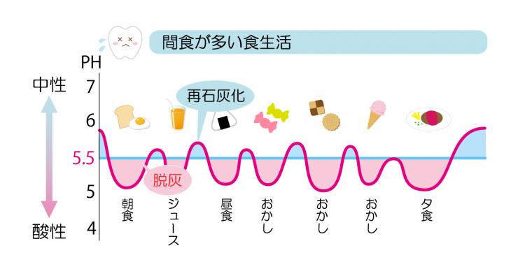 歯磨きをしているのになぜ虫歯になるの?