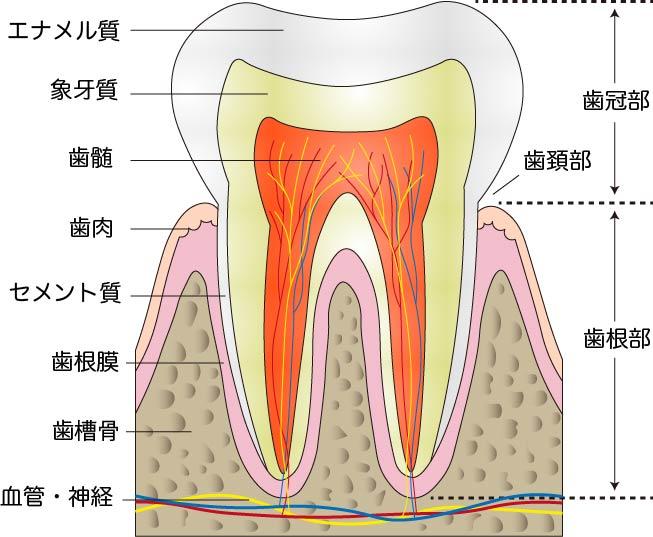 根面う蝕（こんめんうしょく）について