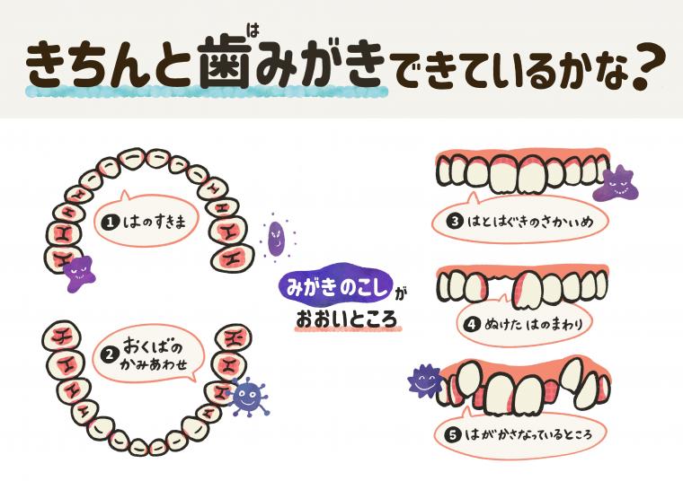 子どもの虫歯予防1