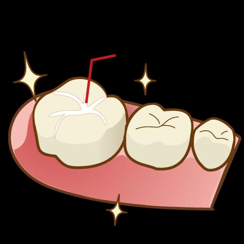 子どもの虫歯予防3