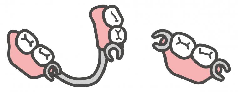 入れ歯について