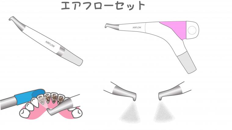 歯のクリーニングの新常識「エアフロー」とは？効果やメリットを歯科医と歯科衛生士が解説