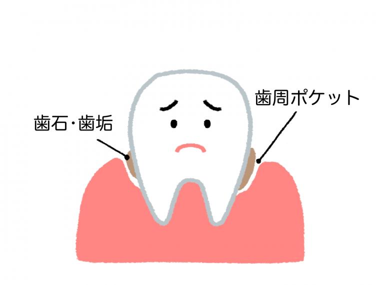 なぜ歯を磨くの?いつ磨いたらいいの?