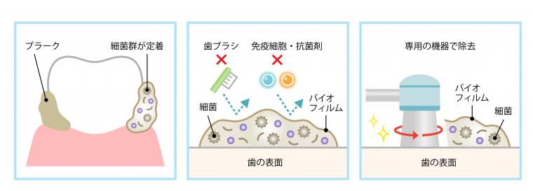 メンテナンスについて