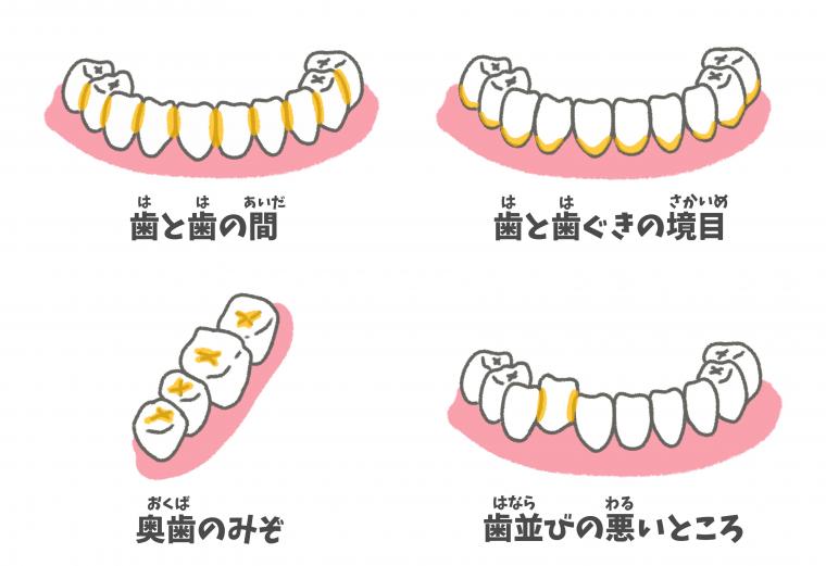 歯周病予防と健康寿命｜予防管理型歯科で行うメインテナンスの重要性