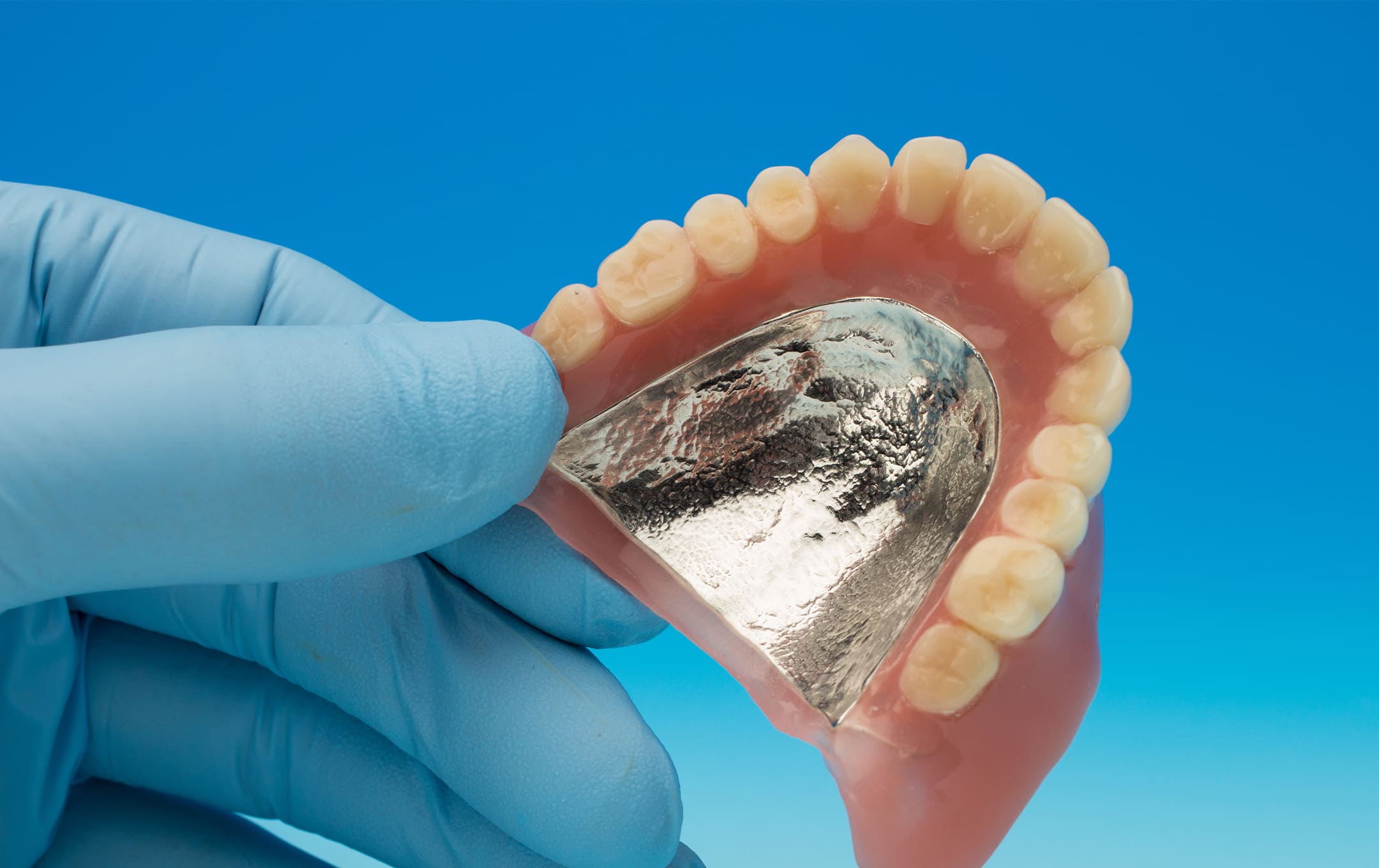 自費診療の入れ歯の特徴
